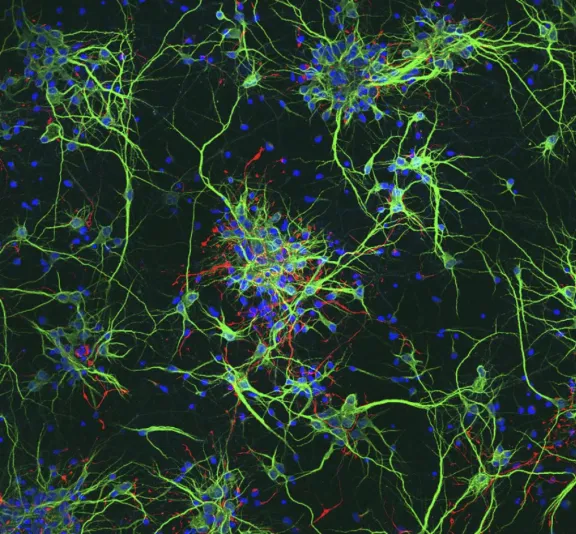 Científicas crean un biomaterial que podría recuperar los daños en la médula espinal