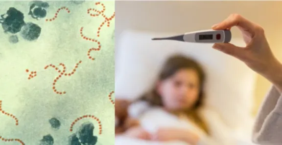 ¿Conoces el Streptococcus pyogenes? esta es la bactería que mató a menor de 7 años en Chillán