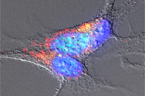 Descubren la presencia de amiloides en la microbiota intestinal asociados con la enfermedad de Parkinson