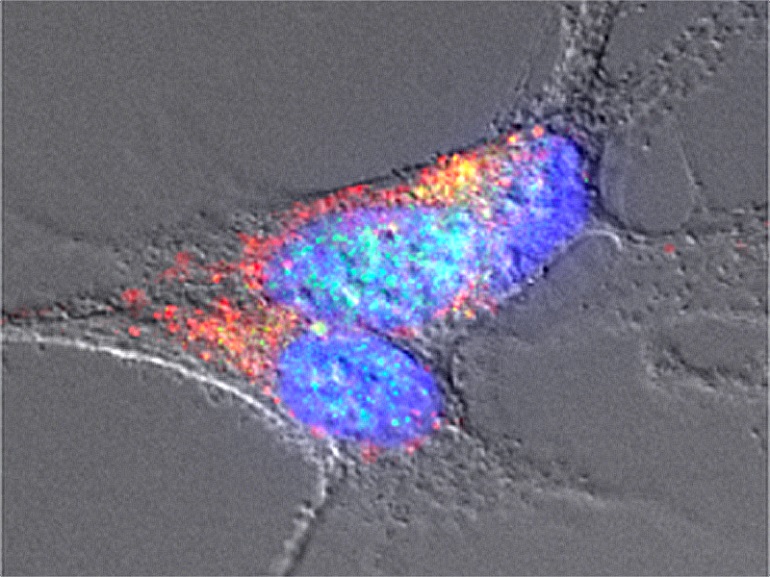 Descubren la presencia de amiloides en la microbiota intestinal asociados con la enfermedad de Parkinson