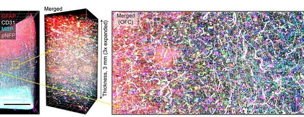 Una nueva técnica permite una visión sin precedentes del cerebro en tiempo récord