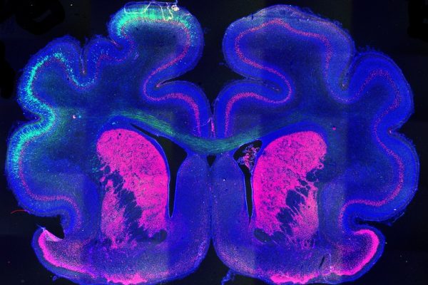 Descubren un mecanismo que sienta las bases para que se produzcan pliegues en la corteza cerebral