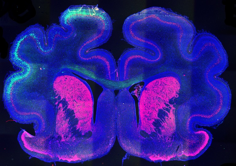 Descubren un mecanismo que sienta las bases para que se produzcan pliegues en la corteza cerebral