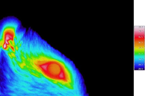 Primera representación anatómica y funcional de la superficie ocular en el sistema nervioso central