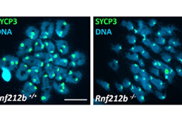 Una proteína tiene la clave de la división celular de la meiosis que origina los óvulos y espermatozoides en mamíferos