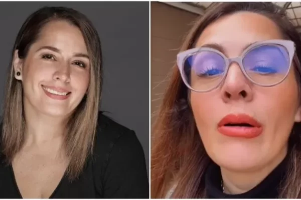 Yiddá Eslava reveló retoquito en los labios y seguidores reaccionan: “¿Qué te pasó?”