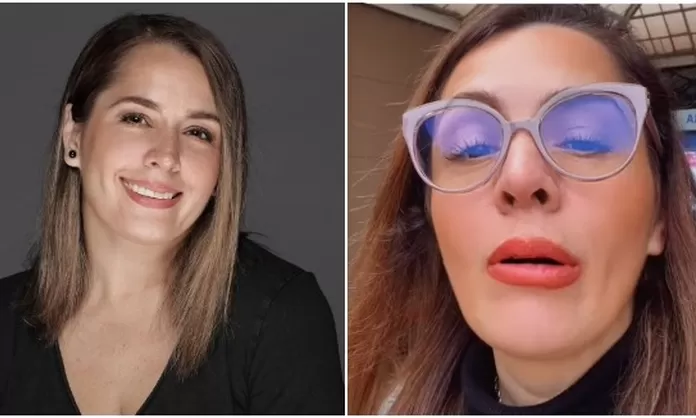 Yiddá Eslava reveló retoquito en los labios y seguidores reaccionan: “¿Qué te pasó?”