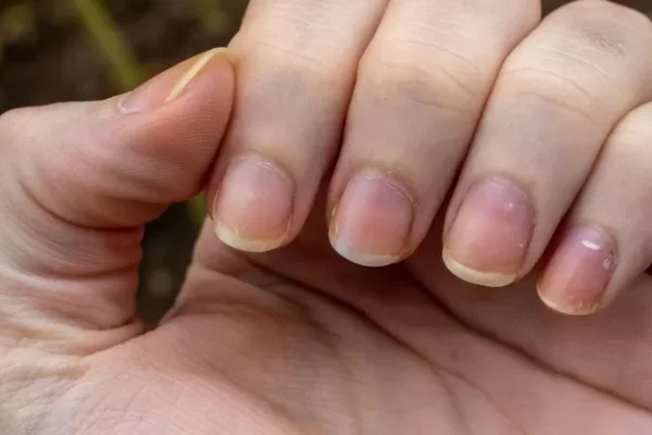 ¿Por qué tus uñas se tiñen de amarillo?