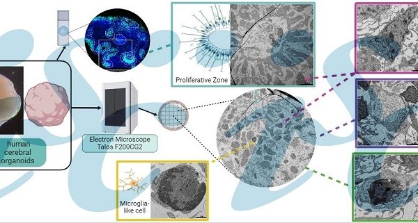 Organoides demuestran capacidad de asemejarse al cerebro humano, facilitando el desarrollo de terapias para enfermedades neurológicas