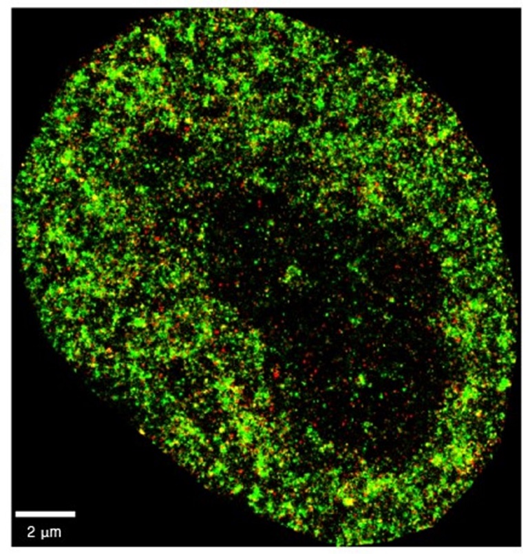 La IA detecta el cáncer y las infecciones virales con precisión nanométrica