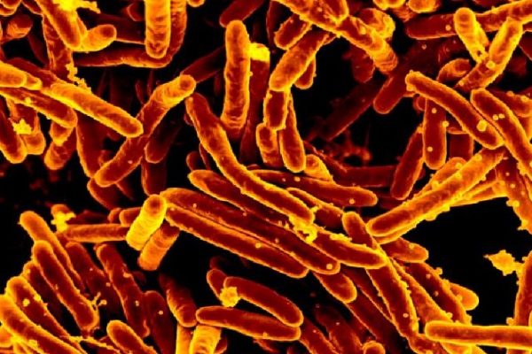 Desarrollan un método de secuenciación genómica que acelera el diagnóstico de la tuberculosis a partir de esputos del paciente