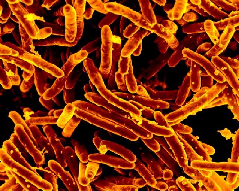 Desarrollan un método de secuenciación genómica que acelera el diagnóstico de la tuberculosis a partir de esputos del paciente