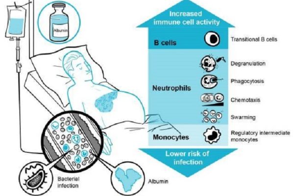 La albúmina mejora la función del sistema inmunológico en pacientes con cirrosis descompensada