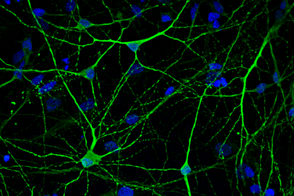 Un protocolo innovador revela la distribución de un receptor clave para la memoria en cerebros con enfermedad de Alzheimer