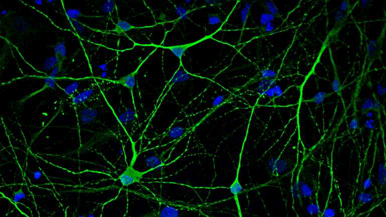 Un protocolo innovador revela la distribución de un receptor clave para la memoria en cerebros con enfermedad de Alzheimer