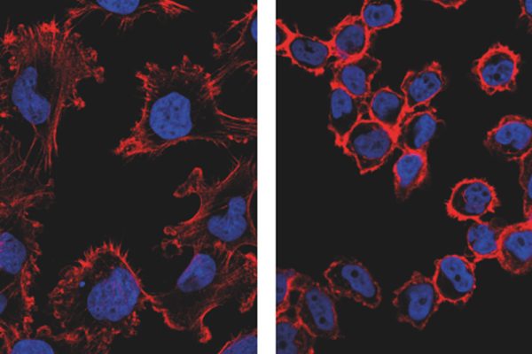 Ensayan una nueva tecnología no invasiva que ataca específicamente a las células cancerosas y suprime su capacidad tumoral