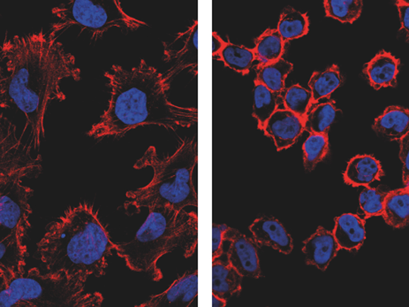 Ensayan una nueva tecnología no invasiva que ataca específicamente a las células cancerosas y suprime su capacidad tumoral