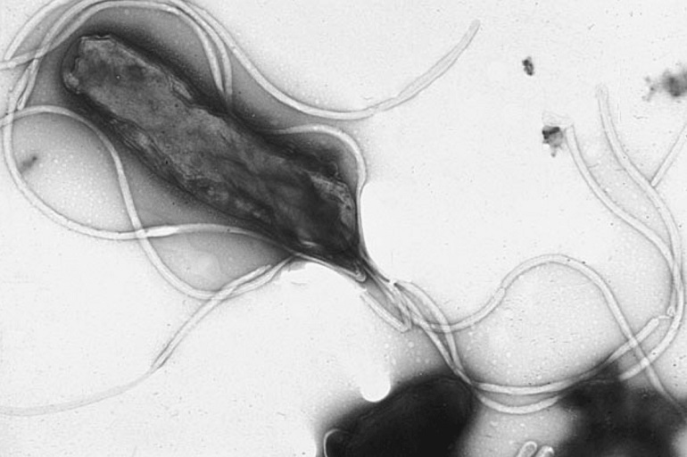 ‘Helicobacter pylori’, la infección silenciosa que causa gastritis, úlceras y cáncer