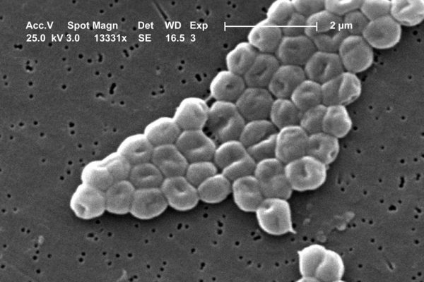 La batalla entre dos virus en una bacteria abre nuevas vías contra la resistencia a antibióticos