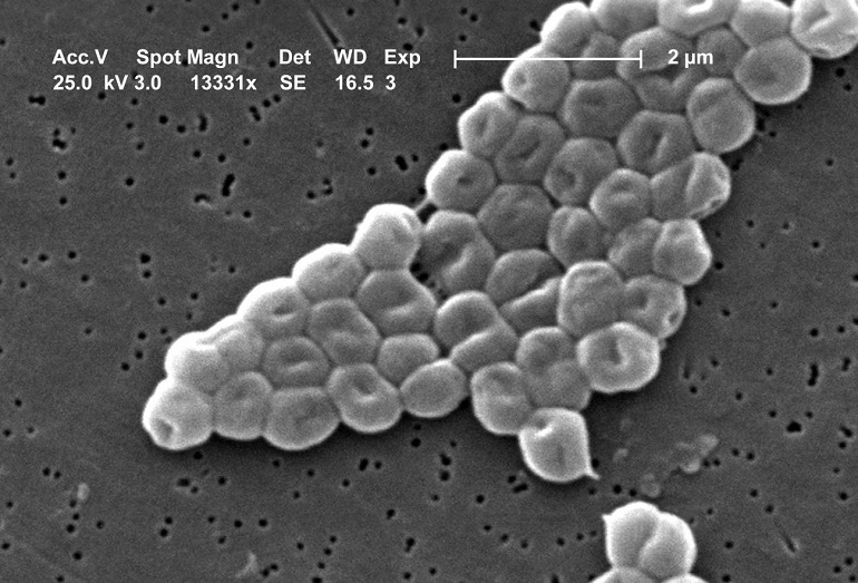 La batalla entre dos virus en una bacteria abre nuevas vías contra la resistencia a antibióticos