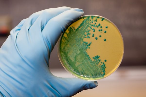 El CSIC patenta un nuevo método más eficaz, sostenible y seguro para combatir la listeria