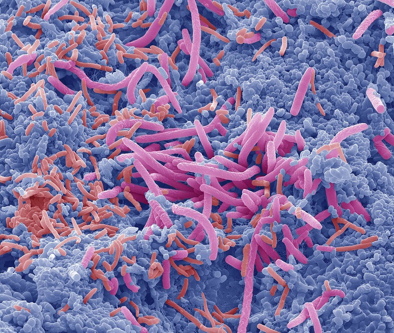 Nexo entre la composición de la microbiota intestinal y los síntomas depresivos en el embarazo