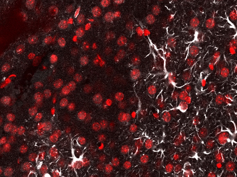 Una nueva ‘linterna molecular’ detecta metástasis cerebral en ratones introduciendo en el cerebro una sonda de luz más fina que un cabello